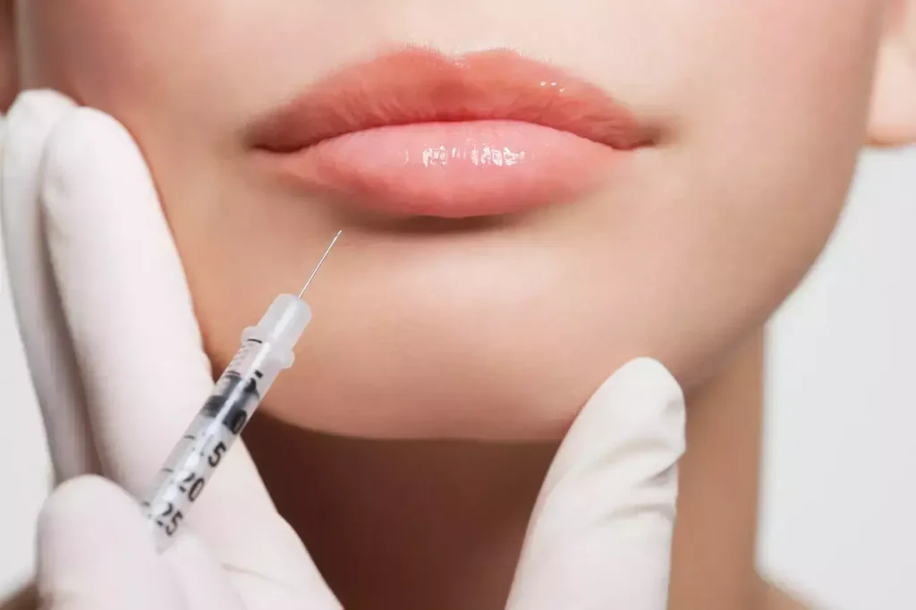 Lip Flip